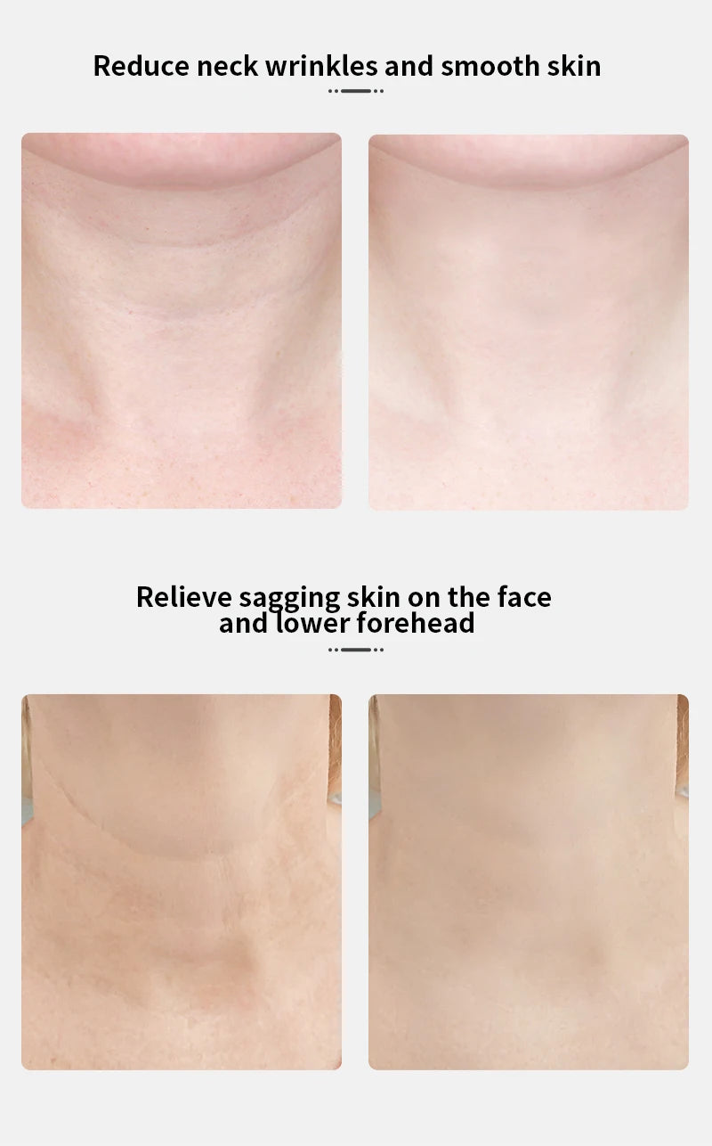 EMS Neck & Face Lifting Device