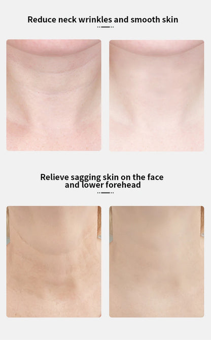 EMS Neck & Face Lifting Device